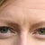 Premature Aging Skin