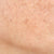 Uneven Tone