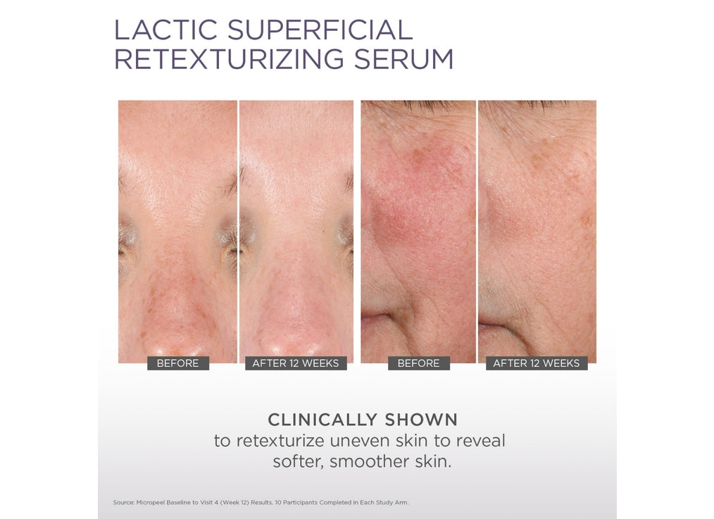 Lactic Superficial Retexturizing Serum